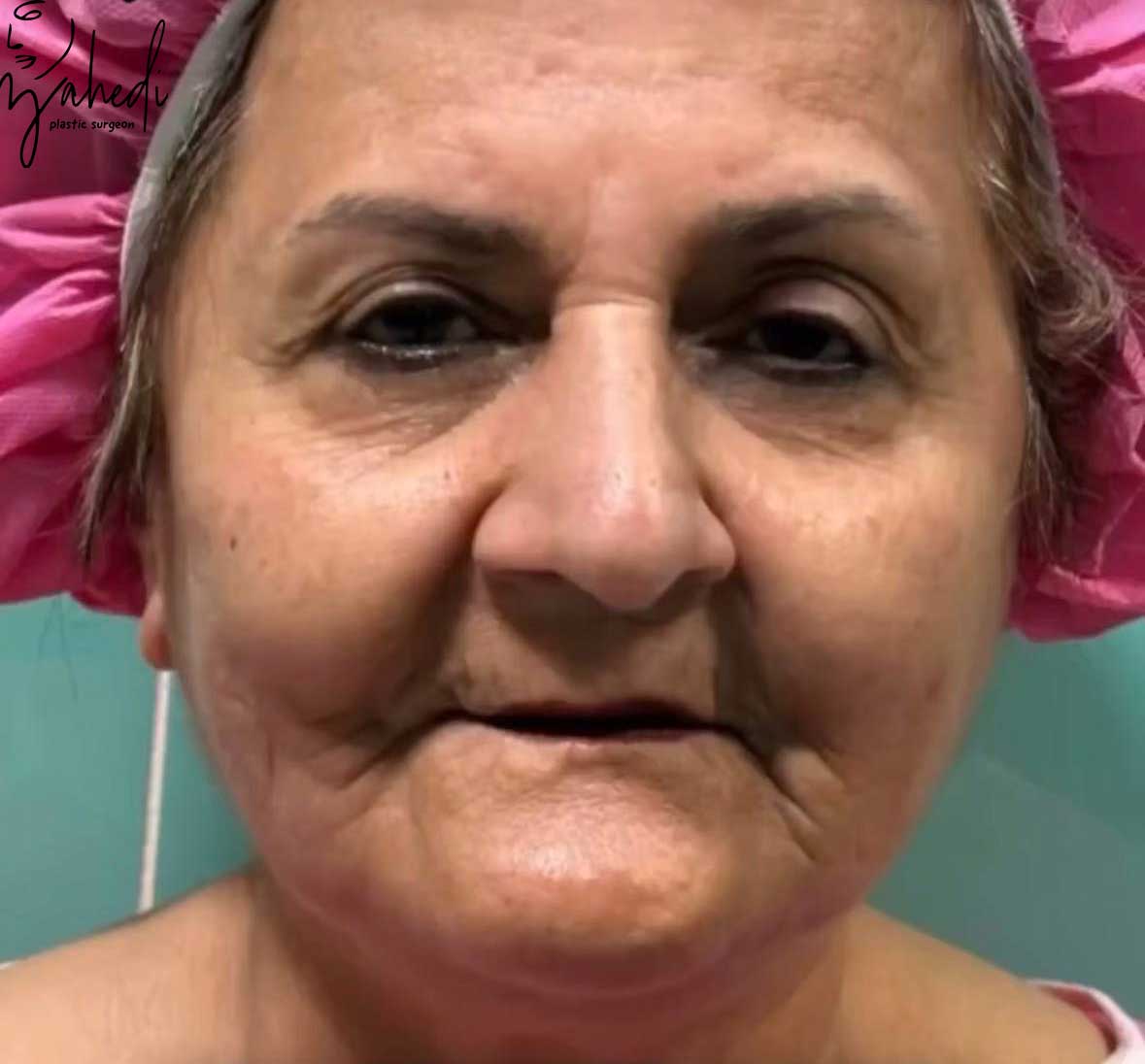 تصویر قبل از درمان