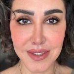 تصویر بعد از درمان