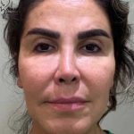 تصویر قبل از درمان