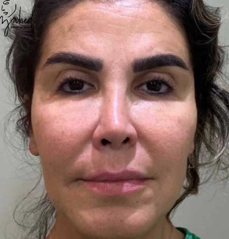 تصویر قبل از درمان